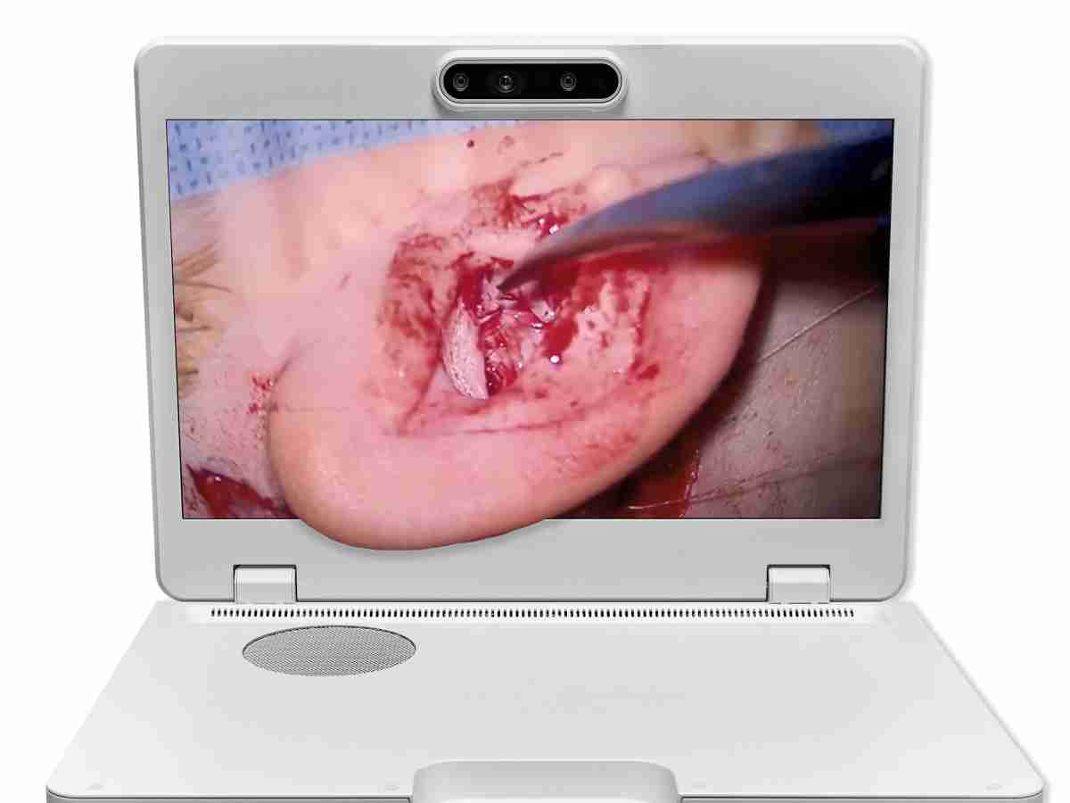 达擎之＂Heads-up 3D显微手术显示系统＂，，，，整合4K裸眼3D显示及眼球追踪系统，，具备快速追踪人眼移动位置功能，，，，减轻医师长时间维持固定姿势的负担，，，，让医师能有更宽广清晰的3D立体视野及更舒适的姿势来执行手术。。。。